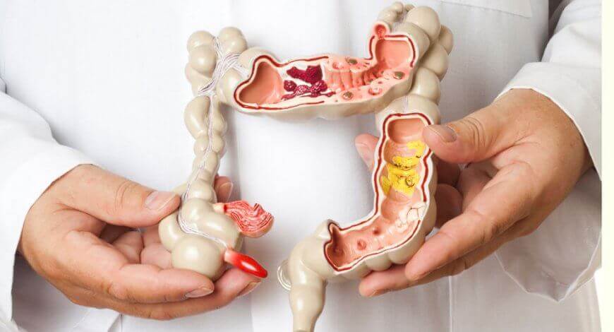 demachiante de colon și detoxifiere a mucusului