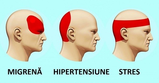 Totul despre durerea de cap: simptome si remedii