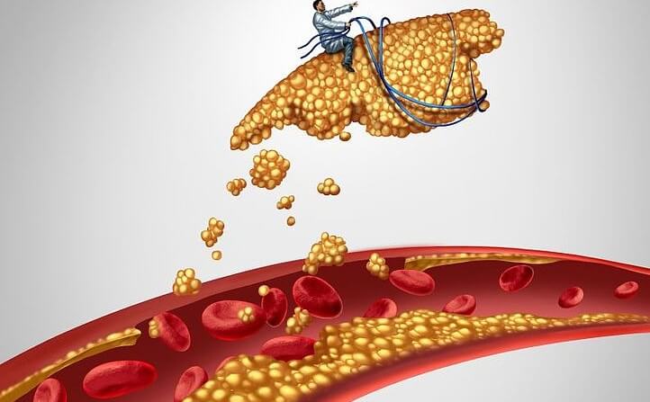 Colesterol — bun HDL si rau LDL, Total | Tabel valori