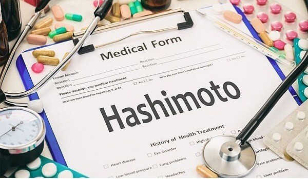 Tiroida Hashimoto: ce este? Cauze, simptome si alimentatie