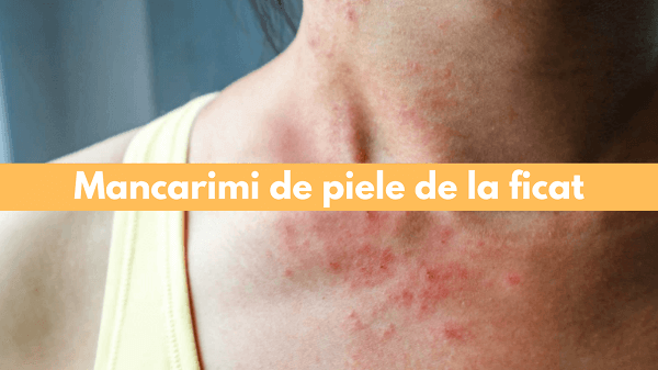 Mancarimi de piele de la ficat - cauze si remedii