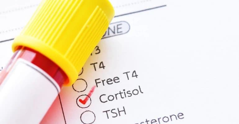 Cortizol sau Hormonul Stresului – Cum poate fi scazut