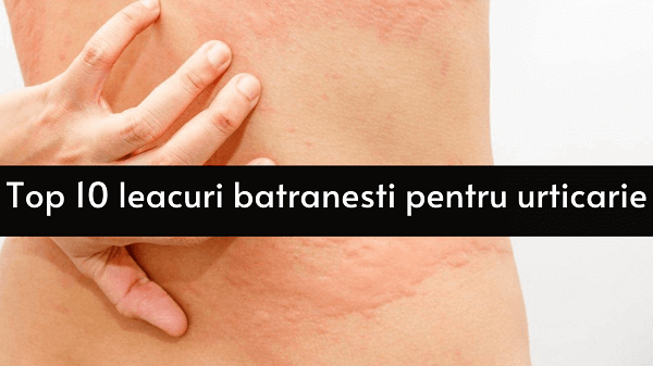 Top 10 leacuri batranesti pentru urticarie