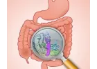 Probleme digestive
