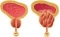 Prostata